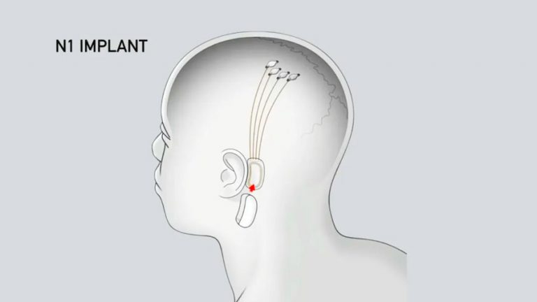 neuralink